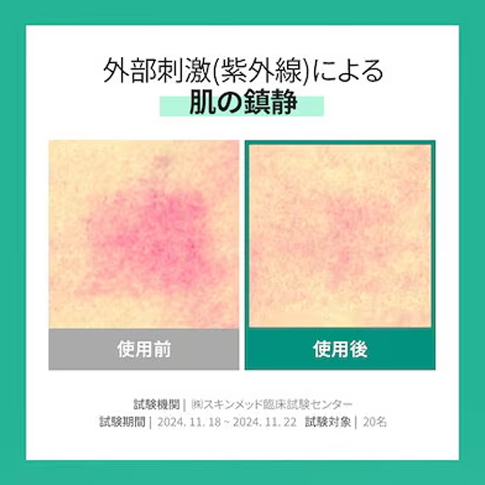 ポストアルファシカカーミングダウンクリーム50ml