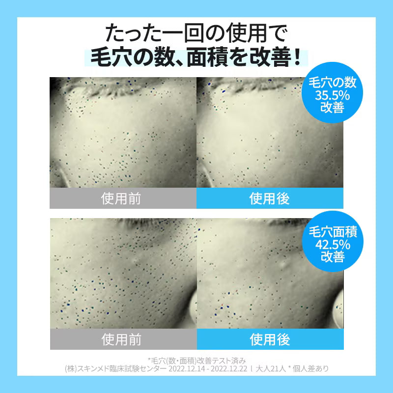 ポストアルファクーリングパッド70枚