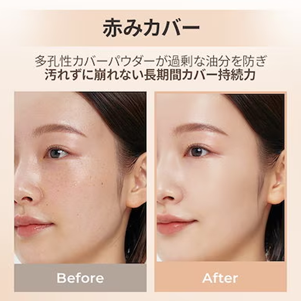 スキンブレミッシュバーム40ml　