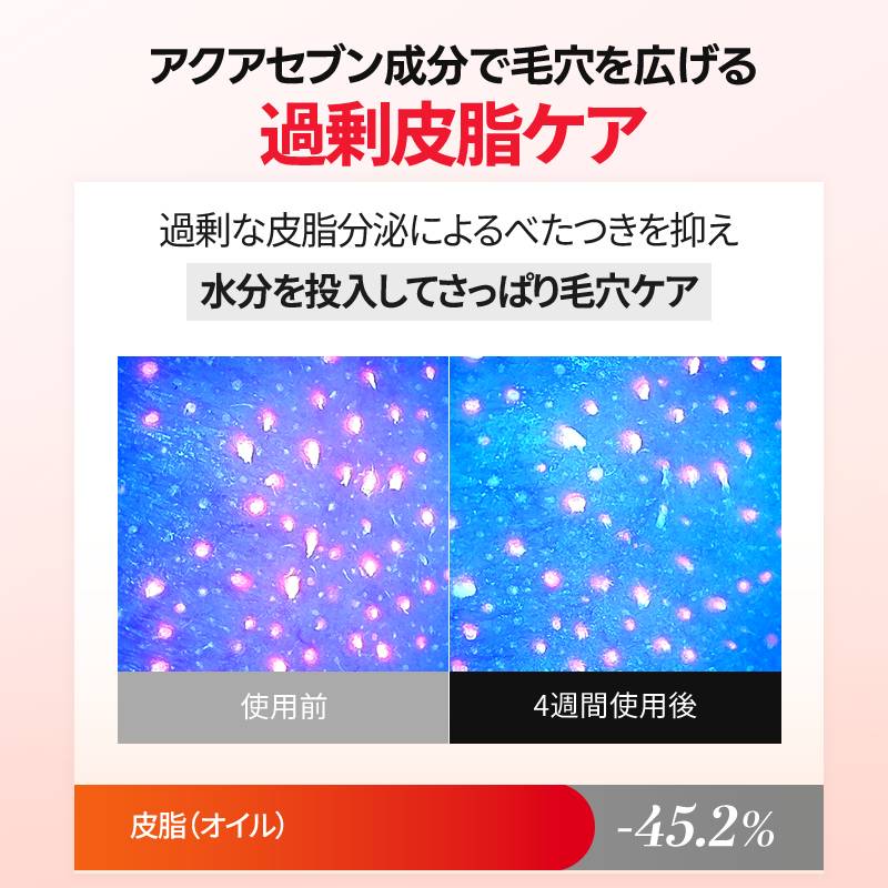レーザーUVポアサンセラム 40ml